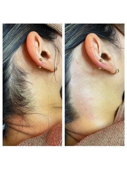 サロンアンドスクール ローズマリー (Salon&School Rosemary)/(Wax)うなじ¥3300もみあげ¥2200