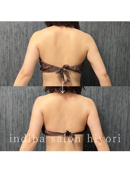 ヒヨリ(hiyori)/《before/after》上半身