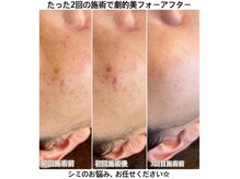 プリンセスモモ 佐世保白岳店(Princes Momo)の雰囲気（最新美容機器導入）