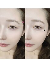 シロン 川越店(Cilon.)/LED160本×下まつげ60本