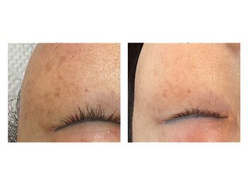 エピシア(EPICIA)/1度でくすみが明るく☆