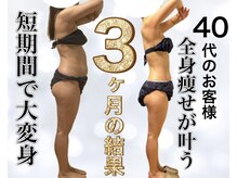 サロン ド ボーテ ラーンジュ 岐阜店(salon de beaut'e L'ange)/ハイパ-ナイフEX2ダイエット痩身