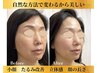 《クーポン選びで迷ったら》あなたのお悩みにぴったりのクーポンをご提案♪