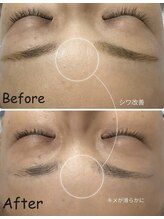 シャムリー(SHAMRY)/セラピール