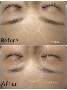 シャムリー(SHAMRY)/セラピール