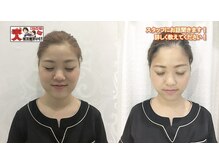 トトノエ プラス 新横浜店(TOTONOE+)/フェイスラインケア/３回/新横浜