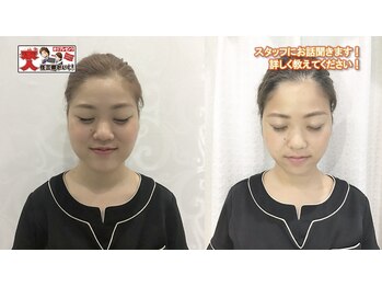 トトノエ プラス 新横浜店(TOTONOE+)/フェイスラインケア/３回/新横浜