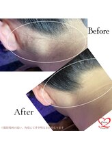 オリオンドットエスツー(Orion.S2)/【Before→After】