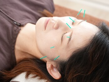 ゆり鍼灸院/美容鍼