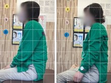 ナオル整体 札幌院(NAORU整体)/円山公園/西２８丁目/猫背矯正