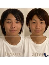 ロータス ビューティー(LOTUS Beauty)/小顔/二回目