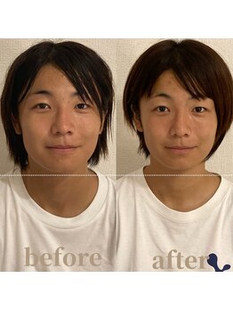 ロータス ビューティー(LOTUS Beauty)/小顔/二回目