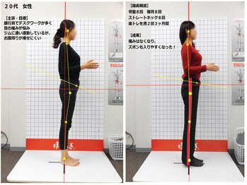 ほねつぎ 府中鍼灸整体院/【症状】肩こり　首