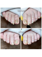 爪切り屋 足楽/足の爪切り