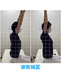 みくる整骨院/整体・骨盤矯正/姿勢改善/肩こり
