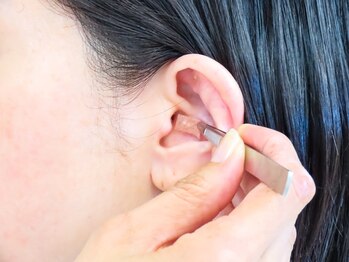 アンビジュー(un bijou)/耳つぼ施術