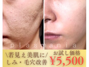 ミュベル(Myubelle)