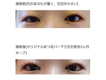 アロマスイーツ(AromaSweets)/目元の左右差解決.まつげパーマ
