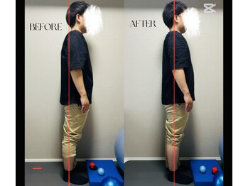 春日整体院ito/【姿勢改善ビフォーアフター】