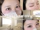 アンフルール ミー(Un Fleur mee)の写真