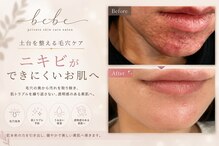 ベベ(bebe)