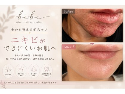 ベベ(bebe)の写真