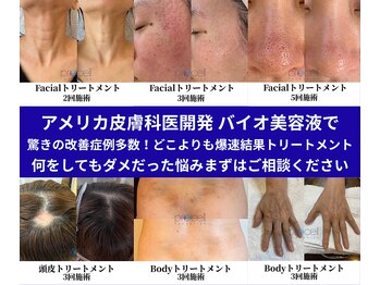 ザ ベッピン(the 別嬪)の写真/アメリカ発しわ/たるみケアと韓国式シミケアで、自分を磨く特別な時間を楽しんで◎