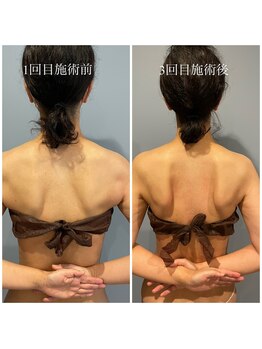 サロンドフィル(Salon de fil)/肩甲骨はがし