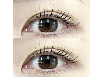 プラスアイ 大宮西口店/メーテルロッド