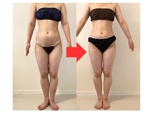 ビーチェリッシュ(B-CHERISH)/20代女性／5回