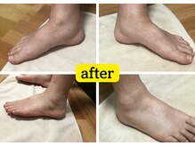 ラスター(Luster)/足のむくみスッキリ