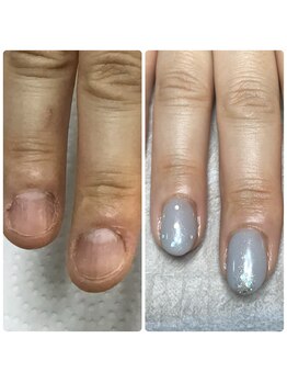 エルナ(elna)/ホームケアが大事です!