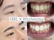 ミガク 京都四条大宮店(MIGAQ)