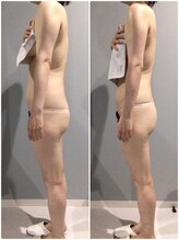 ファロンビューティー(fallon beauty)/痩身ビフォーアフター