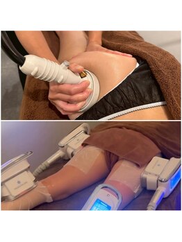 ミエル 恵比寿店(Miel)/ミエルは痩身も大人気♪