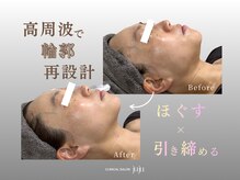 ジュジュ(juju)/フェイスラインで印象を変える