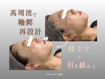 ジュジュ(juju)/フェイスラインで印象を変える