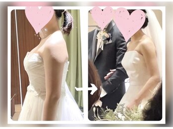 蒼(so)の写真/実績3万人超え！何をしても痩せない二の腕やハミ肉の原因→諸悪の根源は歪みに!?最高の華奢感は歪みの改善!