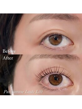 ローリーアイ 吉祥寺/逆さまつ毛さんのお悩み解決