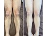 大人気！気になるすね毛もツルスベに！自己処理不要で清潔感のある脚へ