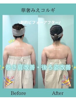 アコガレコガオ 鳥取店/コルギのビフォーアフター