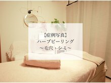 フラーブ(Flourb)/ハーブピーリング｜毛穴シミケア