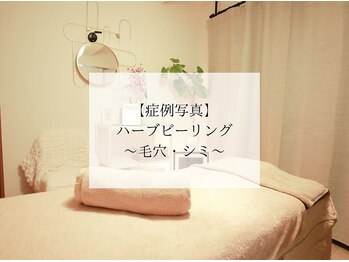 フラーブ(Flourb)/ハーブピーリング|毛穴シミケア