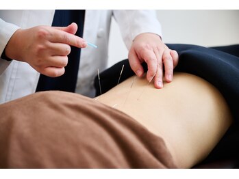 ふうき堂/鍼灸施術