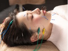 ハリヤベース鍼灸整骨院(HaRiYa BaSe鍼灸整骨院)