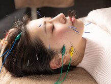 ハリヤベース鍼灸整骨院(HaRiYa BaSe鍼灸整骨院)