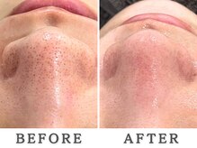 レヴィア(Revia)の雰囲気（毛穴洗浄/黒ずみ/角栓/毛穴/六本木/ハーブピーリング/小顔）