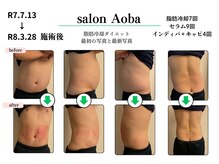サロンアオバ 稲毛店(salon Aoba)の雰囲気（脂肪冷却で無理のない痩身ダイエットが魅力です）