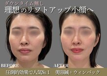 ミプラス鍼灸スタジオ