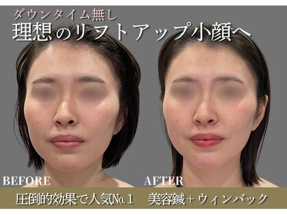 ミプラス鍼灸スタジオの写真